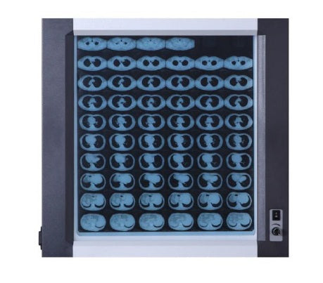 Negatoscopio sencillo