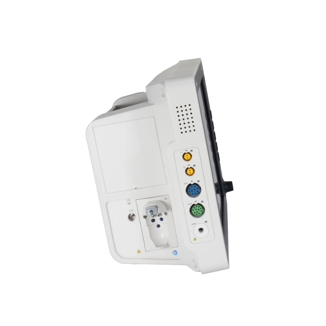 MONITOR DE SIGNOS VITALES