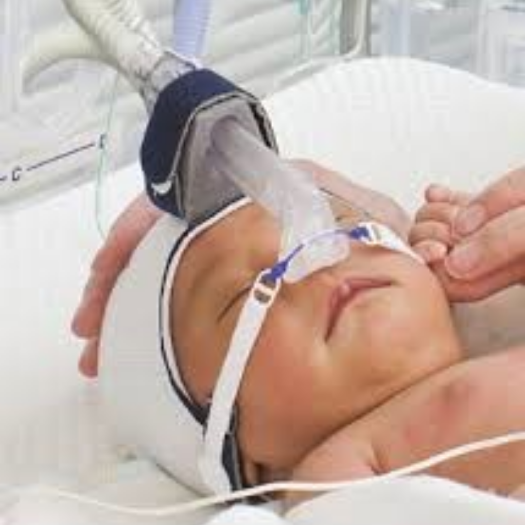 Tubo nasal para CPAP de burbuja de 70 mm Fisher & paykel
