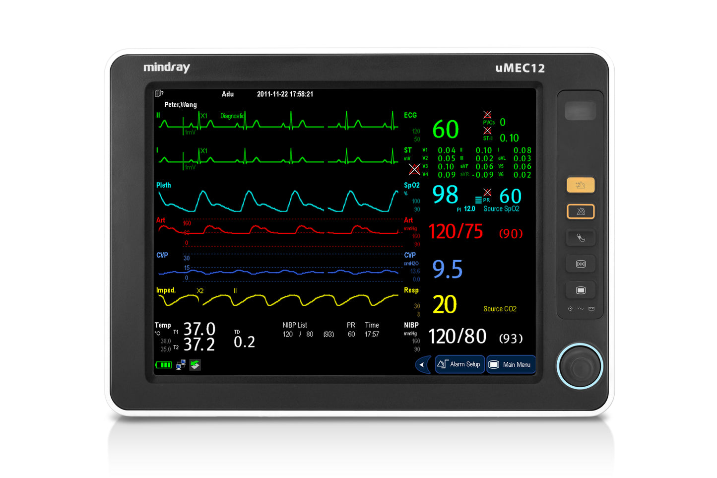 monitor de signos vitales umec 12